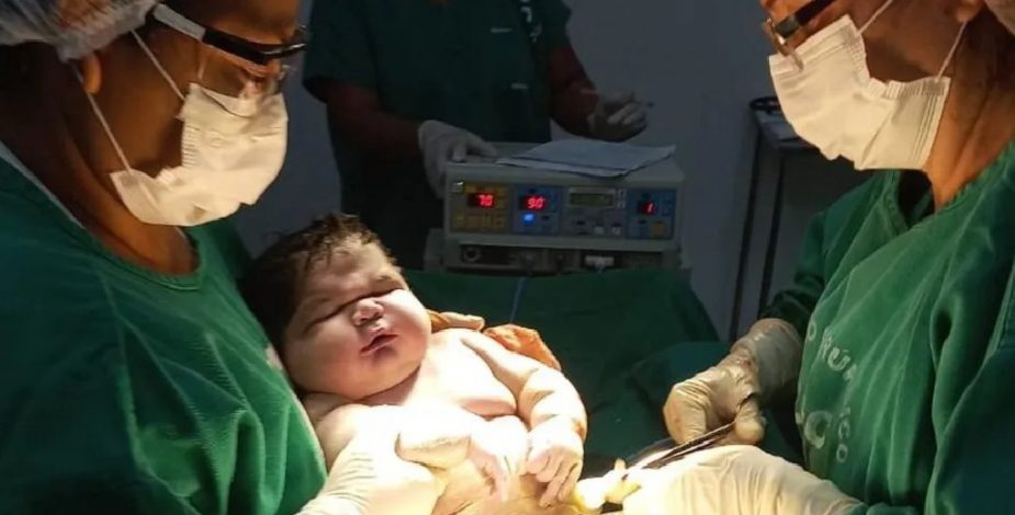 Mujer da a luz a un bebé de más de 7 kilos usa pañales para niños de 9