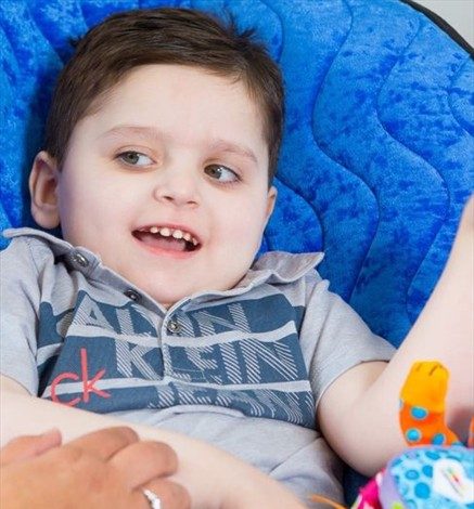 Niño con extraña enfermedad recuperó su habilidad para sonreír tomando leche