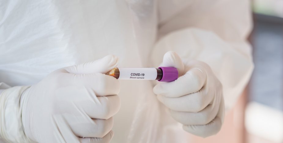 Cámara de la Innovación Farmacéutica y Covid-19: La vacuna podría estar dentro de los próximos 12, 18 meses