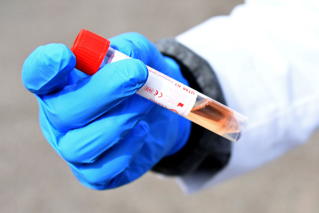 Un test de coronavirus se realiza en la Universidad de Nevada Las Vegas