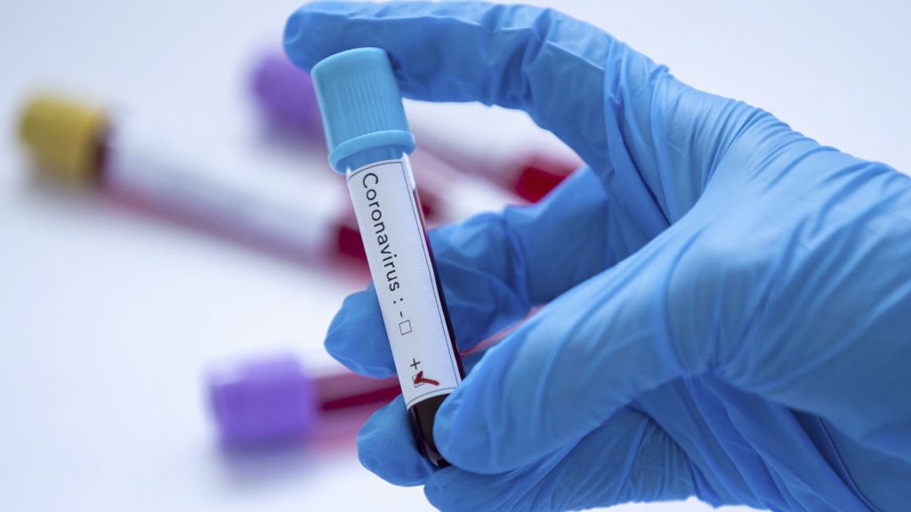 Minsal informó que hubo 4.942 nuevos contagios y ya son 113.628 los casos de coronavirus