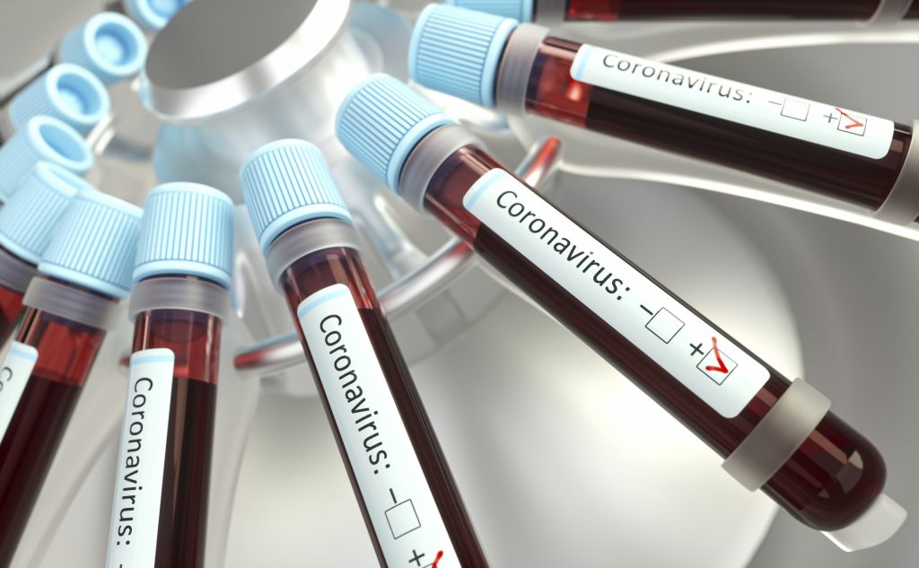 Minsal informó que hubo 4.207 nuevos casos y ya son 122.499 los contagiados de coronavirus