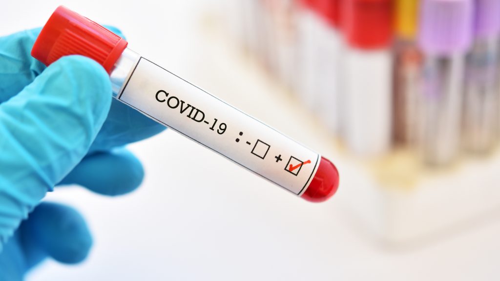 Minsal informó que hubo 4.664 nuevos casos y ya son 118.292 los contagiados con coronavirus