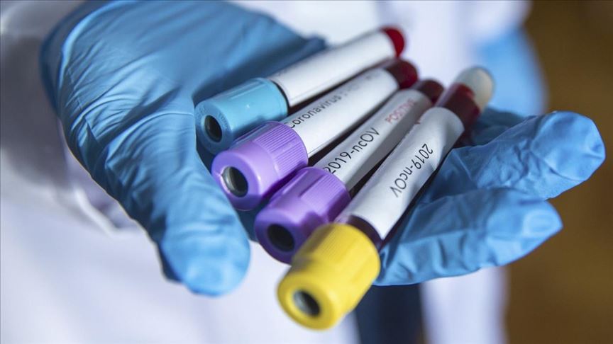 Minsal informó que hubo 5.246 nuevos casos y ya son 127.745 los contagiados de coronavirus