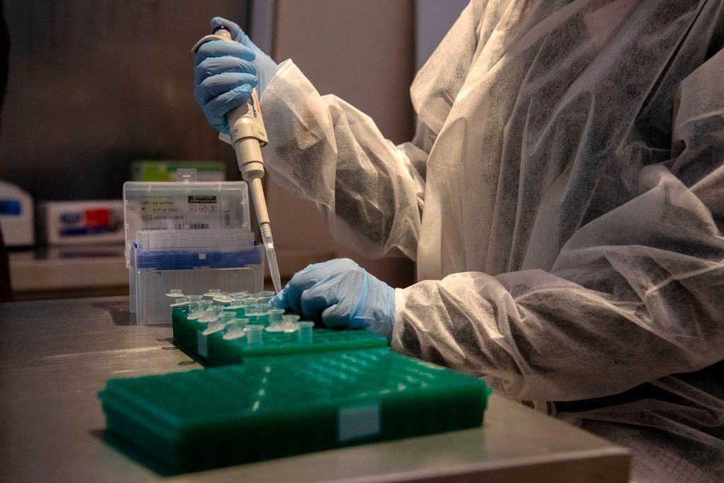 Minsal informó que hubo 1.566 casos nuevos y ya son 376.616 los contagiados con coronavirus
