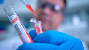 Investigación arrojó que el coronavirus estaba en Brasil desde noviembre