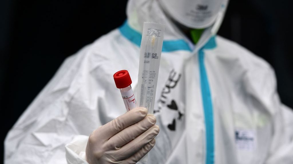 Argentina registró importante alza y superó a China en cantidad de contagios por Covid-19