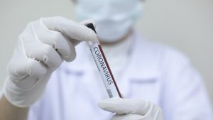 Suspenden funcionamiento de laboratorio en hospital de Temuco por contaminación de test PCR para Covid-19
