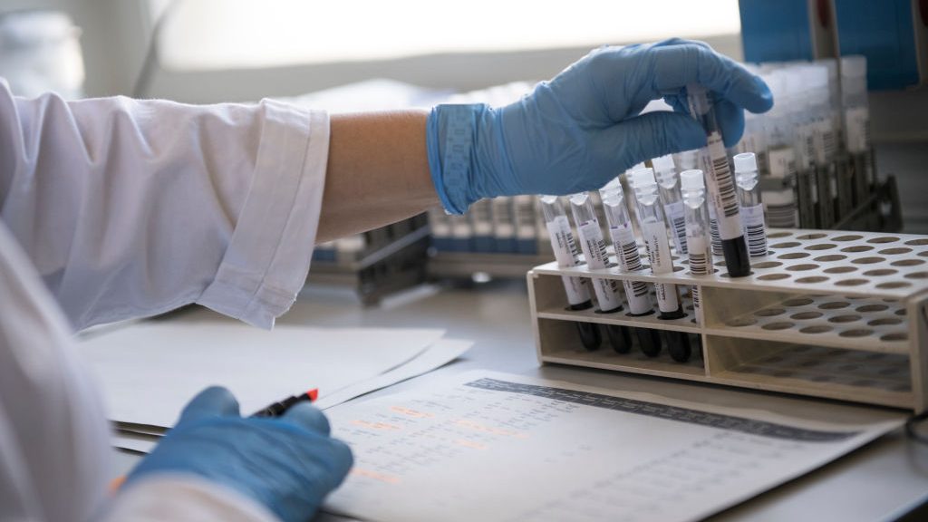 Informe Epidemiológico: DEIS registró 17.075 fallecimientos asociados al Covid-19 entre casos confirmados y sospechosos