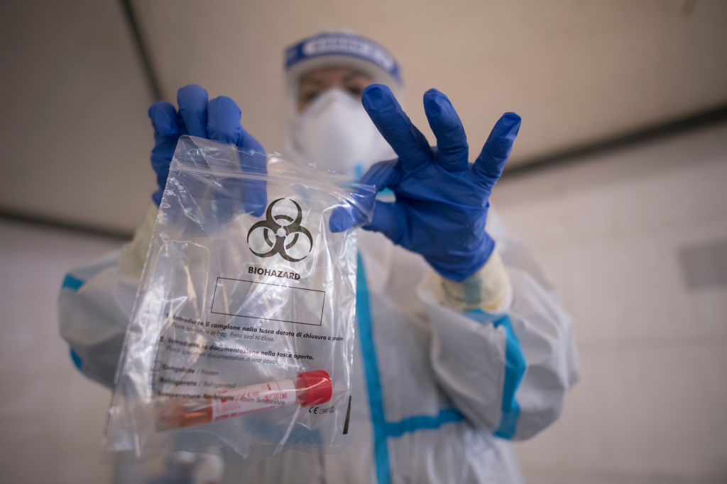 Examen del nuevo coronavirus en Turín