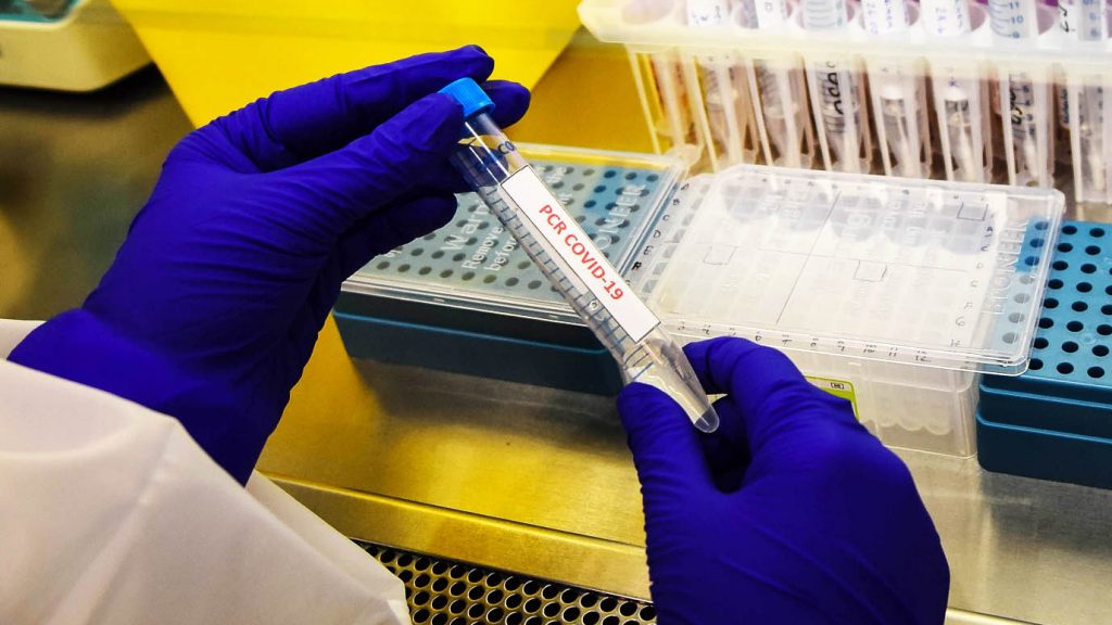Informe Epidemiológico: DEIS registró 20.439 fallecimientos asociados al Covid-19 entre casos confirmados y sospechosos
