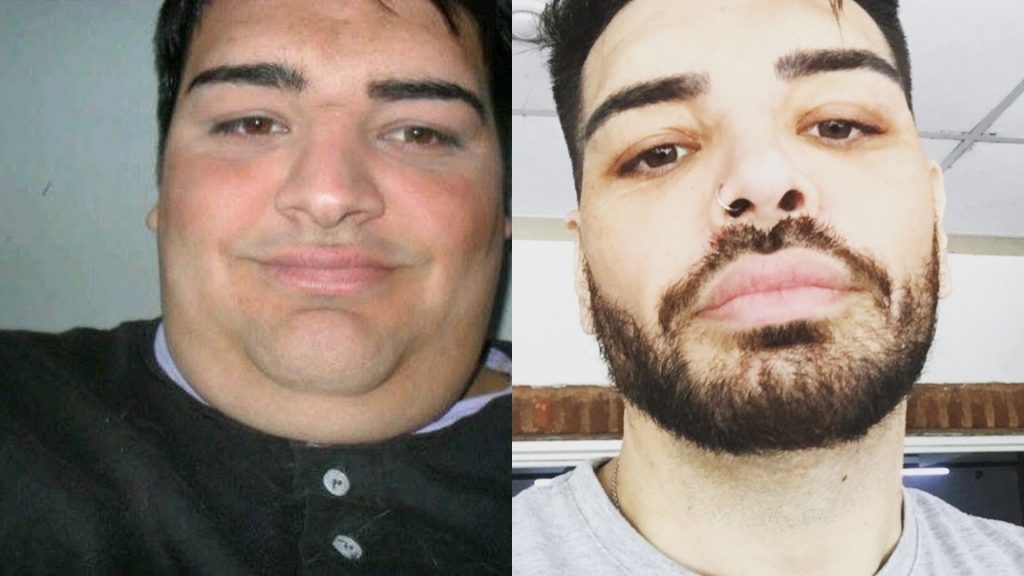 Argentino ex "Cuestión de peso" se operó 28 veces para ser como Ricky Martin