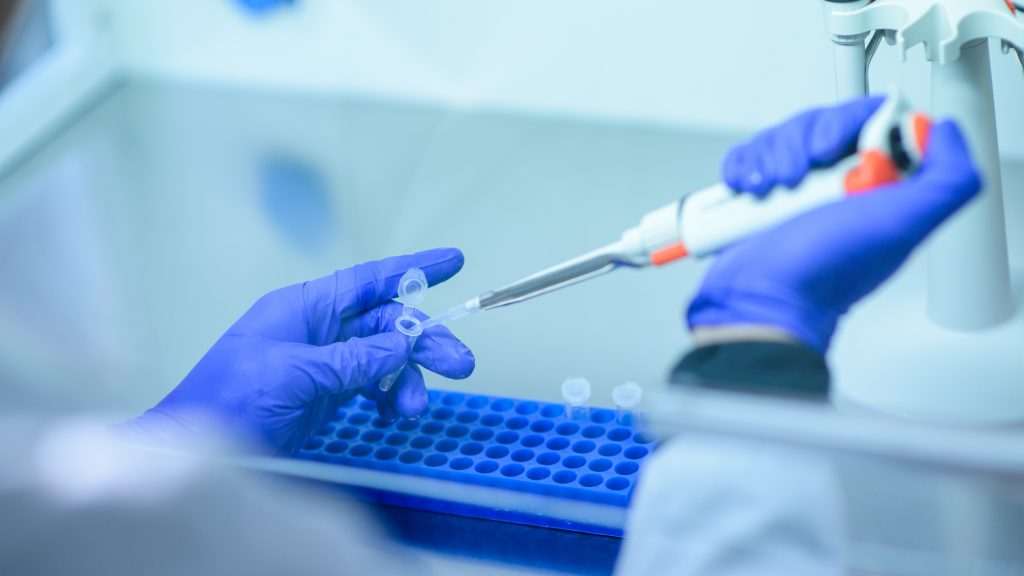 Doctor analizó diferencia entre vacuna Pfizer y Oxford: "Son vacunas que tienen un vector discretamente distinto"