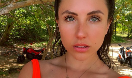"Quiero amarme": exchica reality Ángela Duarte muestra su rostro con acné y sin maquillaje