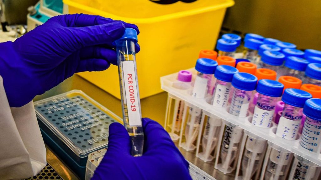Informe Epidemiológico: Casos activos en la Región Metropolitana bordean los 5.500