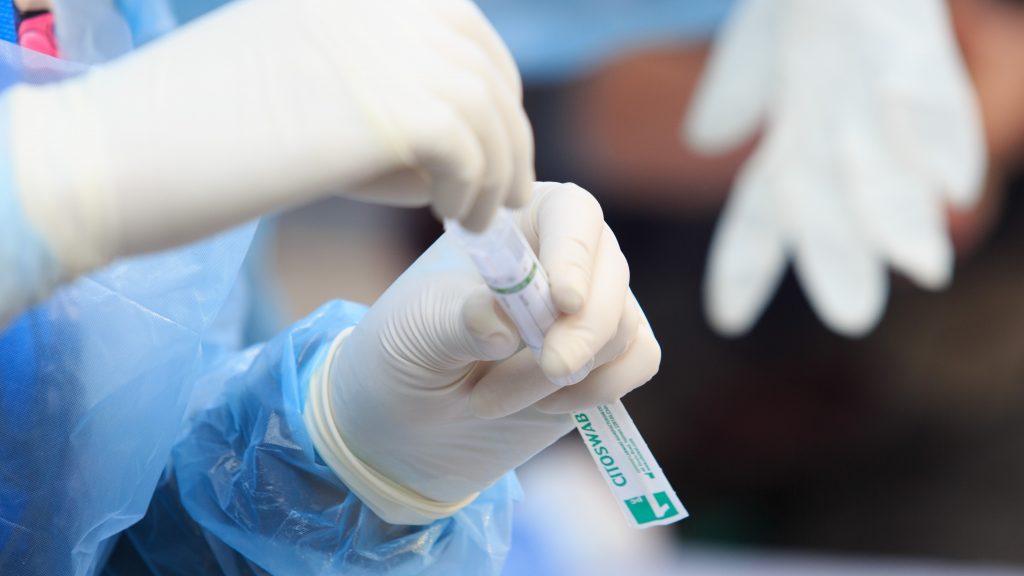 Informe Epidemiológico: casos activos a nivel país superan los 12 mil y Maipú encabeza el listado