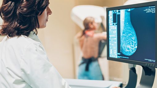Cáncer de mama: Sociedad Chilena de Mastología advirtió que "las campañas deberíamos hacerlas de enero a diciembre"