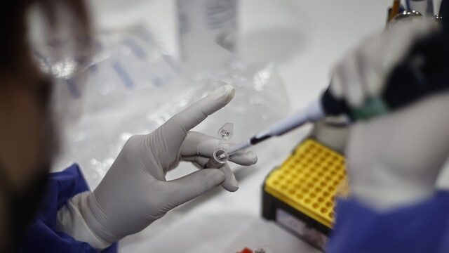 Epidemiólogo Luis Herrada por viruela del mono: “La alerta de la OMS es razonable”