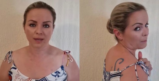 Mujer denuncia que su marido la obligó a marcarse sus iniciales con un fierro caliente y luego tatuarse la cicatriz