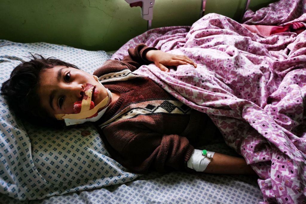 Un niño es atendido en un hospital de Afganistán tras un atentado explosivo
