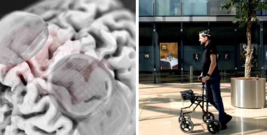 Increíble innovación médica: implante cerebral devuelve la capacidad de caminar a un hombre paralítico