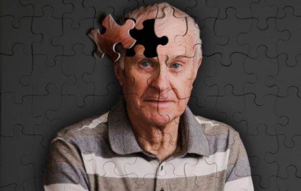 Alzheimer en Chile: ¿Cuál es la realidad de este diagnóstico en el país?